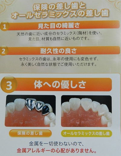 保険の差し歯とオールセラミックスの差し歯