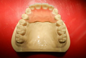 セラミックスの人口歯