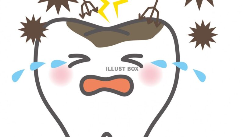 親知らずのせいで虫歯に!?