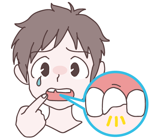 転んで前歯が欠けた時どうする？