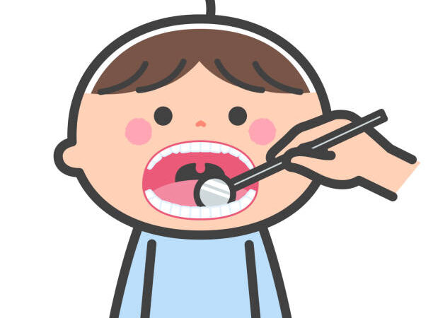 歯の先天性欠損（せんてんせいけっそん）って？