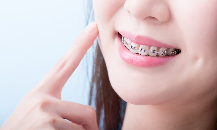 親知らずと矯正の関係